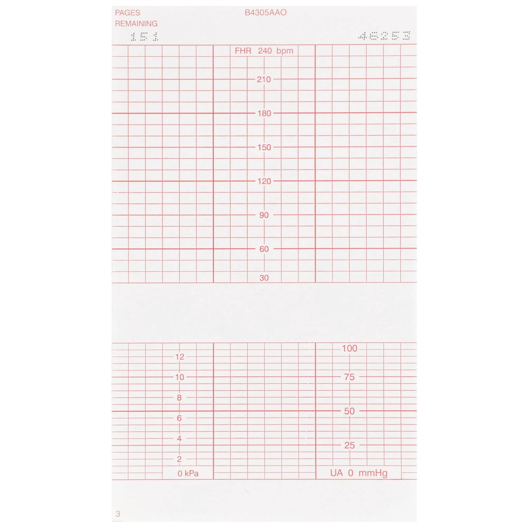 McKesson Fetal Monitoring Paper